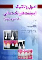 کتاب اصول و تکنیک ایمپلنت های تک دندانی (جراحی و پروتز)نشر رویان پژو 