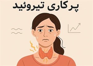 پاورپوینت غده تیروئید