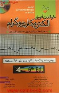 خواندن فوری الکتروکاردیوگرام ECG