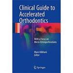 Clinical Guide to Accelerated Orthodontics With a Focus on Micro- Osteoperforations