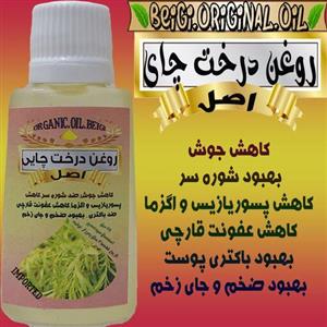 روغن درخت چای  30 میل (کیفیت عالی و تضمینی)