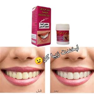 خمیر جرم گیر کیمیا، بهترین جرم گیر موجود در بازار، سفید کننده و رفع لک های ناشی از مصرف چای و قهوه، ارسال فوری 