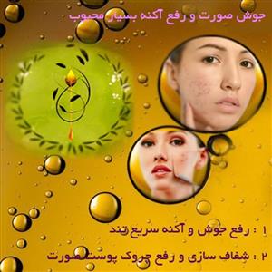 رفع جوش و آکنه صورت با روغن های گیاهی و موضعی میتا