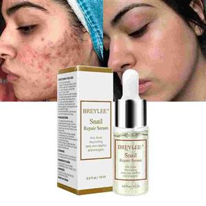 سرم حلزون بریلی