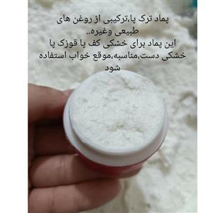 کرم پماد ترک پا