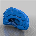 مولاژ  سه بعدی نیمکره ی مغز (hemisphere)
