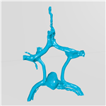 فایل مولاژ سه بعدی آنوریسم حلقه ویلیس (circle of willis aneurysm)