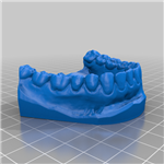 فایل مولاژ سه بعدی دندان (dental model)