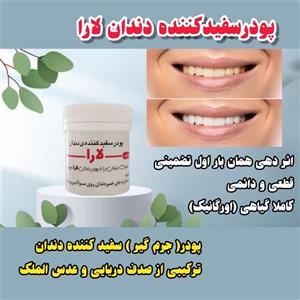 سفیدکننده دندان