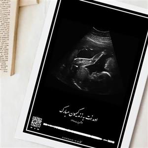 قاب موزیکال (سونوگرافی جنین)