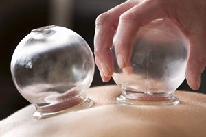 پاورپوینت تاثیر حجامت بر روح و روان