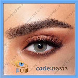 لنز طبی رنگی آکوا دیلی روزانه (استفاده سبک تا یک ماه) کد DG313 