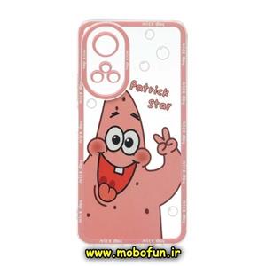 قاب گوشی Honor X7 4G آنر ژله ای شفاف فانتزی طرح پاتریک محافظ لنز دار کد 32