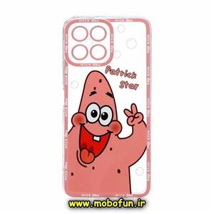 قاب گوشی Honor X8 4G آنر ژله ای شفاف فانتزی طرح پاتریک محافظ لنز دار کد 23