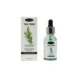 سرم پوست مکس لیدی مدل Tea Tree حجم 30 میلی لیتر 0010 