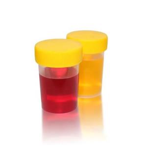 یورین باتل غیر استریل نیمه شفاف 25ML  (بسته 30 تایی)