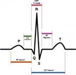 پاورپوینت کامل و جامع با عنوان بررسی ریتم طبیعی قلب یا ریتم سینوسی در 15 اسلاید