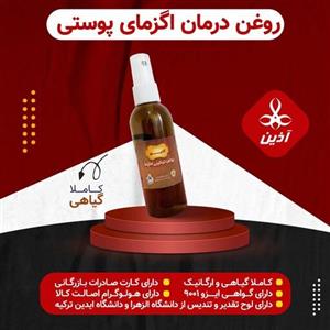 پک کامل روغن پماد و مالجبن  اگزما  پوستی آذین