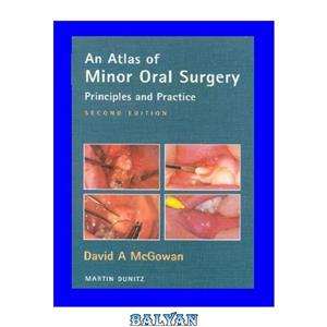 دانلود کتاب Atlas of Minor Oral Surgery: Principles and Practice