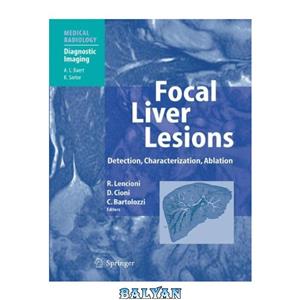 دانلود کتاب Focal Liver Lesions Detection, Characterization, Ablation 