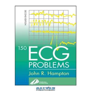 دانلود کتاب 150 ECG Problems