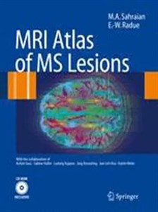 دانلود کتاب MRI Atlas of MS Lesions