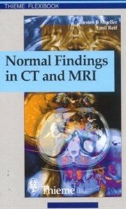 دانلود کتاب Normal Findings in CT and MRI