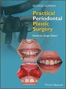 دانلود کتاب Practical Periodontal Plastic Surgery