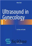 دانلود کتاب Ultrasound in gynecology : an atlas and guide – سونوگرافی در زنان: اطلس و راهنما