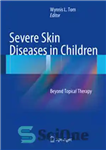 دانلود کتاب Severe Skin Diseases in Children: Beyond Topical Therapy – بیماری های پوستی شدید در کودکان: فراتر از درمان...