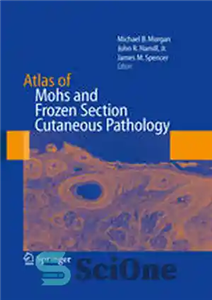 دانلود کتاب Atlas of Mohs and Frozen Section Cutaneous Pathology اسیب شناسی پوستی و 