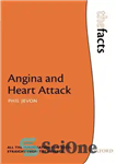 دانلود کتاب Angina and Heart Attack – آنژین و حمله قلبی