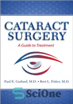 دانلود کتاب Cataract Surgery: A Guide to Treatment – جراحی آب مروارید: راهنمای درمان