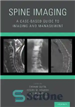 دانلود کتاب Spine Imaging: A Case-Based Guide to Imaging and Management – تصویربرداری ستون فقرات: راهنمای موردی برای تصویربرداری و...