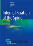 دانلود کتاب Internal Fixation of the Spine: Principles and Practice – تثبیت داخلی ستون فقرات: اصول و تمرین