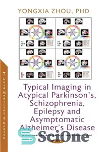 دانلود کتاب Typical imaging in atypical Parkinson’s, schizophrenia, epilepsy and asymptomatic Alzheimer’s disease – تصویربرداری معمولی در پارکینسون آتیپیک، اسکیزوفرنی،...