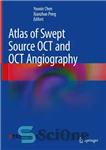 دانلود کتاب Atlas of Swept Source OCT and OCT Angiography – Atlas of Swept Source OCT و OCT آنژیوگرافی