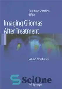 دانلود کتاب Imaging Gliomas After Treatment: A Case-based Atlas تصویربرداری گلیوما پس از درمان: اطلسی مبتنی بر مورد 