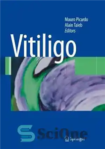 دانلود کتاب Vitiligo – ویتیلیگو