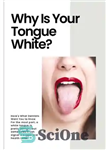 دانلود کتاب Why Is Your Tongue White eBook – کتاب الکترونیکی چرا زبان شما سفید است؟