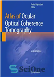 دانلود کتاب Atlas of Ocular Optical Coherence Tomography اطلس توموگرافی انسجام نوری چشمی 