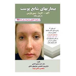 کتاب بیماریهای شایع پوست آکنه، اگزما، پسوریازیس به زبان ساده اثر دکتر احمد محمود آبادی