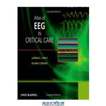 دانلود کتاب Atlas of EEG in Critical Care