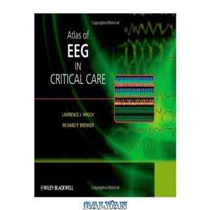 دانلود کتاب Atlas of EEG in Critical Care 