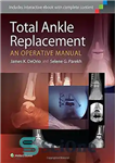 دانلود کتاب Total ankle replacement : an operative manual – جایگزینی کامل مچ پا: کتابچه راهنمای عمل