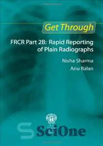 دانلود کتاب Get through FRCR part 2B : rapid reporting of plain radiographs – از طریق FRCR قسمت 2B: گزارش...