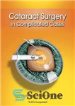 دانلود کتاب Cataract Surgery in Complicated Cases – جراحی آب مروارید در موارد پیچیده