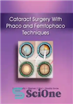 دانلود کتاب Cataract surgery phaco and femtophaco techniques – تکنیک های فیکو و فمتوفاکو جراحی آب مروارید