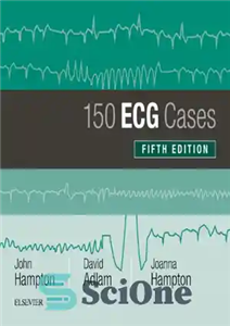 دانلود کتاب 150 ECG Cases [CONVERTED PDF] – 150 مورد نوار قلب [PDF تبدیل شده]