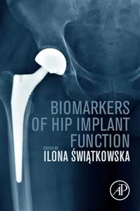 Biomarkers of Hip Implant Function 1st Edition – بیومارکرهای عملکرد ایمپلنت هیپ ویرایش اول ۲۰۲۳